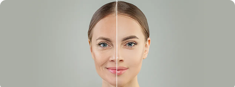 Skincare before after face